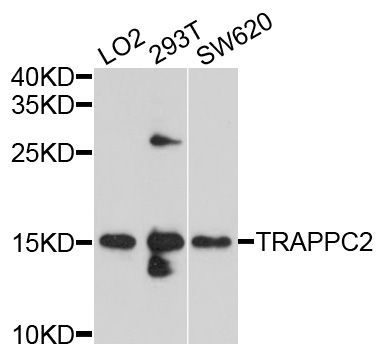 Western blot - TRAPPC2 Polyclonal Antibody (144-10465)
