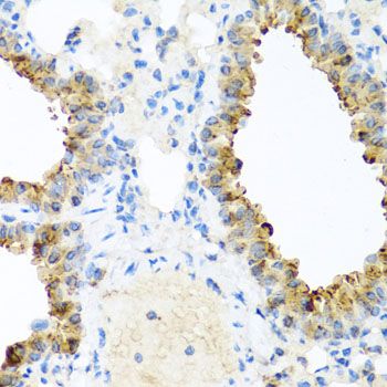 Immunohistochemistry - NIN antibody (144-08215)