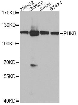 Western blot - PHKB antibody (144-08015)