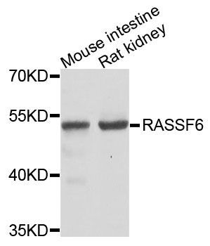 Western blot - RASSF6 Polyclonal Antibody (144-05187)