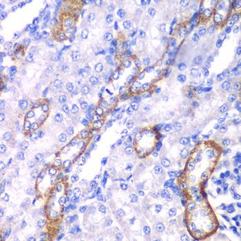 Immunohistochemistry - MYO1C Polyclonal Antibody (144-06936)