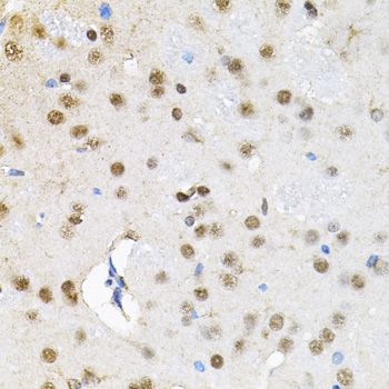 Immunohistochemistry - BAF60a Polyclonal Antibody (144-09950)