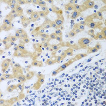 Immunohistochemistry - SHBG antibody (144-07450)