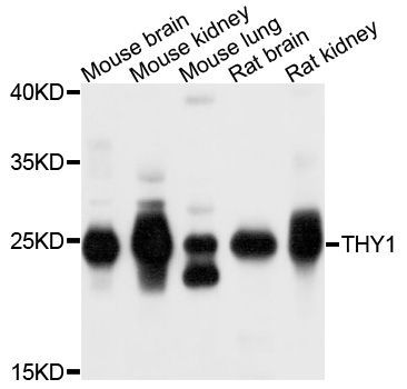 Western blot - THY1 Polyclonal Antibody (144-02126)