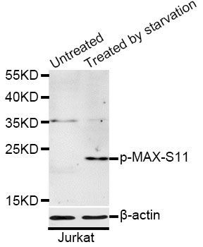 Western blot - Phospho-MAX-S11 antibody (144-50072)