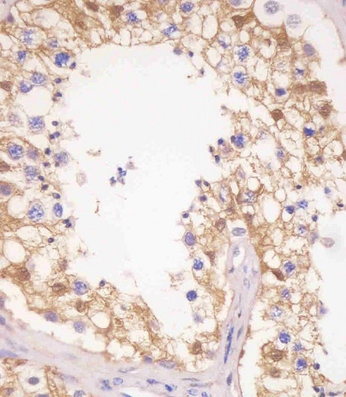 IHC-P
