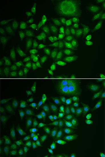 Immunofluorescence - SCG2 Polyclonal Antibody (144-06425)