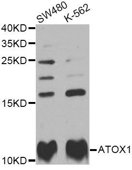 Western blot - ATOX1 Polyclonal Antibody (144-06874)