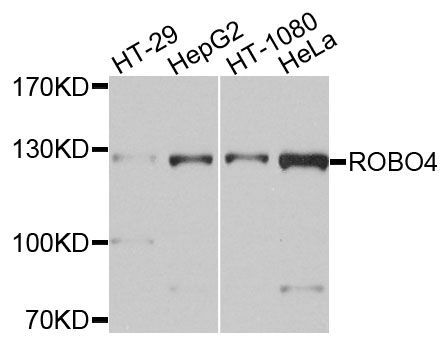 Western blot - ROBO4 antibody (144-09876)