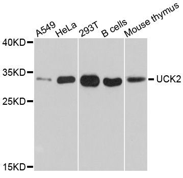 Western blot - UCK2 Polyclonal Antibody (144-10815)