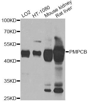 Western blot - PMPCB antibody (144-012549)