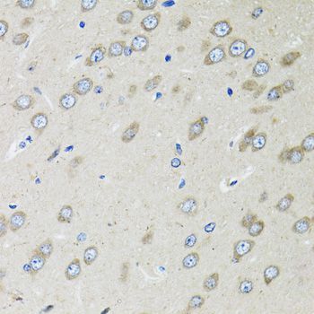 Immunohistochemistry - OGDH antibody (144-012477)