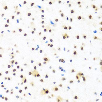 Immunohistochemistry - FUBP1 Polyclonal Antibody (144-05587)