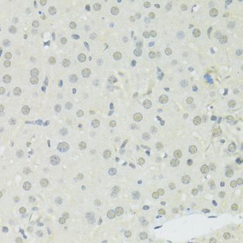Immunohistochemistry - BRCA1 Polyclonal Antibody (144-11549)