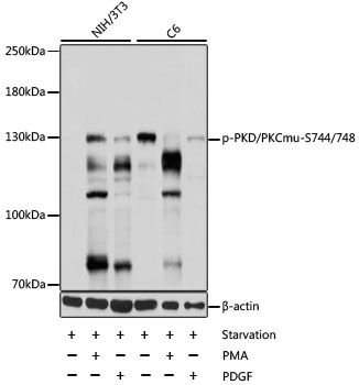 Western blot - Phospho-PKD/PKCmu-S744/748 antibody (144-61503)