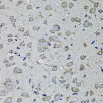 Immunohistochemistry - IL1A antibody (144-01316)