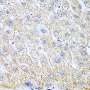 Immunohistochemistry - PTGS1 antibody (144-07341)