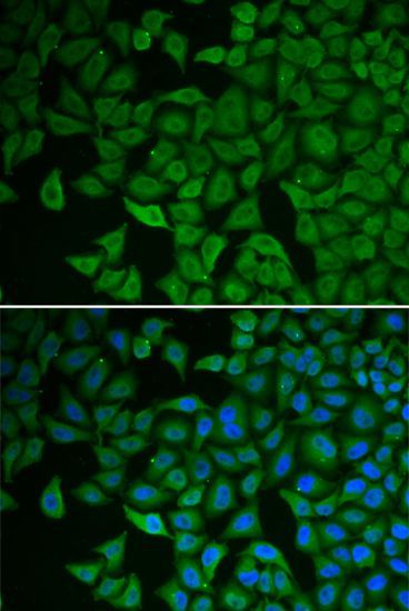 Immunofluorescence - CHEK2 Polyclonal Antibody (144-60023)