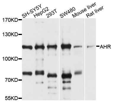 Western blot - AHR antibody (144-01451)