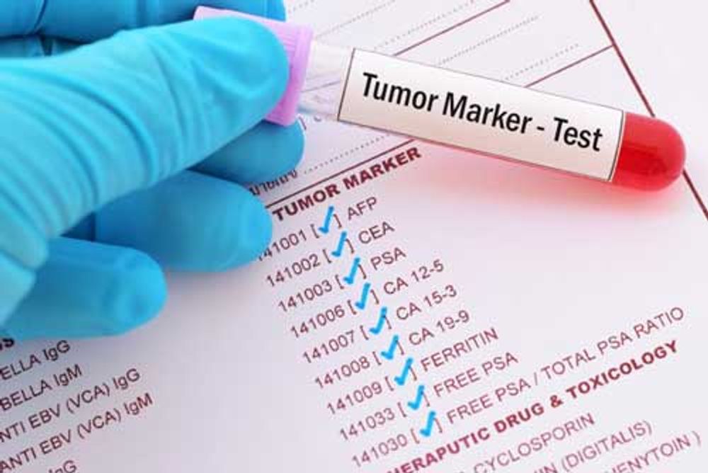 Tumor marker test