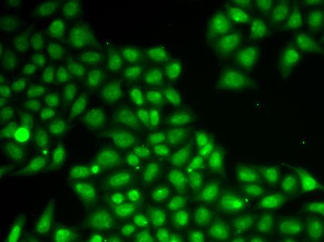 Immunofluorescence - FEN1 Polyclonal Antibody (144-01175)