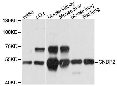 Western blot - CNDP2 Polyclonal Antibody (144-600541)