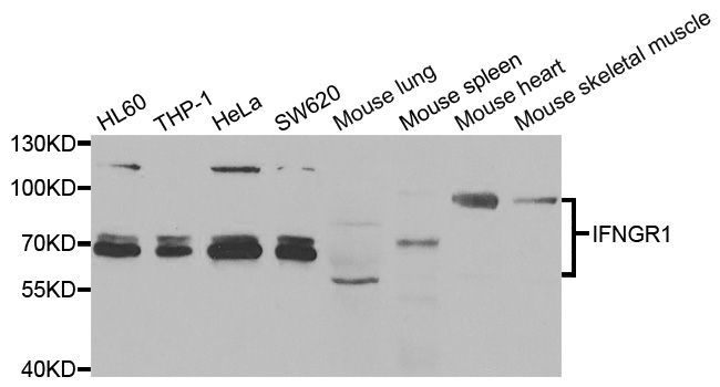 Western blot - IFNGR1 antibody (144-05748)