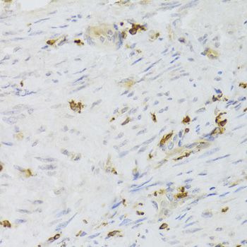 Immunohistochemistry - LSP1 Antibody (144-05617)