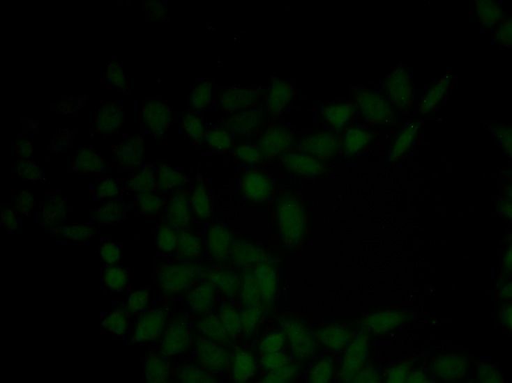 Immunofluorescence - KRT5 antibody (144-02662)