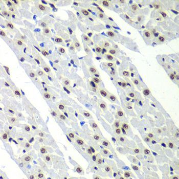 Immunohistochemistry - SF3B2 Polyclonal Antibody (144-05875)