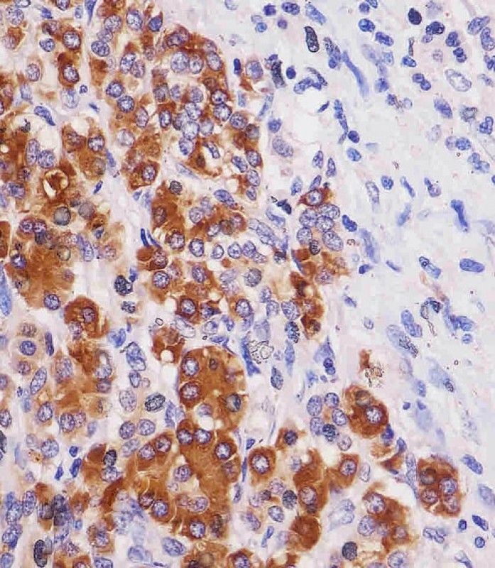 IHC-P