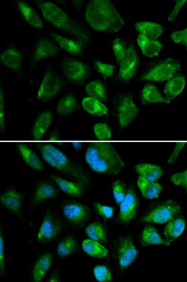 Immunofluorescence - KIR2DL3 antibody (144-01698)
