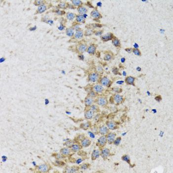 Immunohistochemistry - CDK1 Polyclonal Antibody (144-00220)
