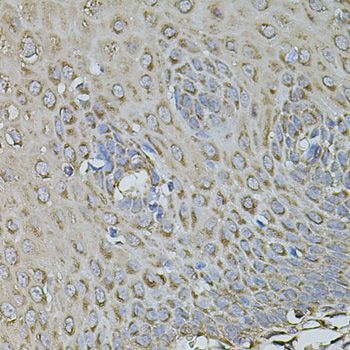 Immunohistochemistry - FDX1 antibody (144-09815)