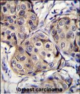 IHC-P