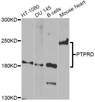 Western blot - PTPRD Antibody (144-08559)