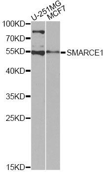 Western blot - [KO Validated] SMARCE1 Polyclonal Antibody (144-602973)