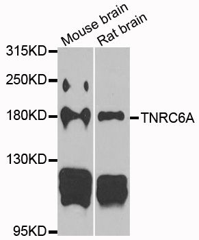 Western blot - TNRC6A antibody (144-06115)
