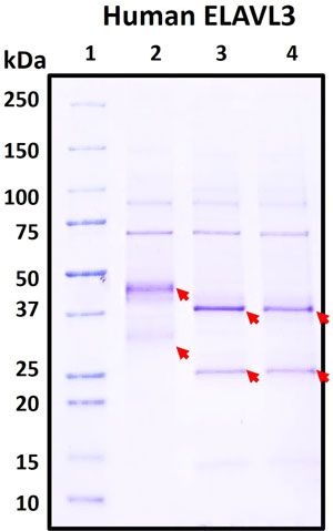 SDS-PAGE