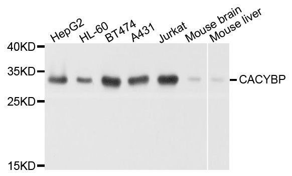 Western blot - CACYBP antibody (144-08757)