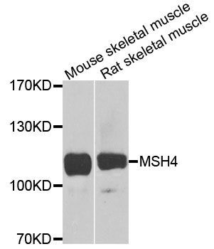 Western blot - MSH4 Polyclonal Antibody (144-08556)