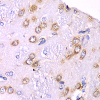 Immunohistochemistry - RPS3A Polyclonal Antibody (144-05885)