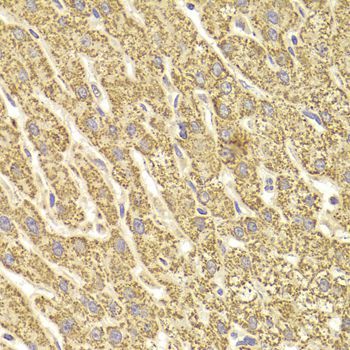 Immunohistochemistry - ATP5B Polyclonal Antibody (144-05769)