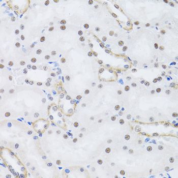 Immunohistochemistry - PRPF19 antibody (144-06706)