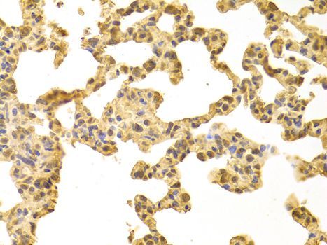 Immunohistochemistry - PPP4C Polyclonal Antibody (144-02109)