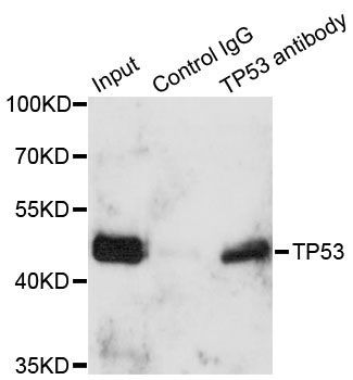 Immunoprecipitation - TP53 Polyclonal Antibody (144-05761)