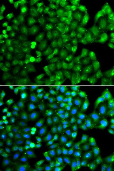 Immunofluorescence - HLA-DRB1 antibody (144-07685)