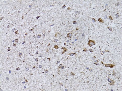 Immunohistochemistry - RARA Polyclonal Antibody (144-00370)