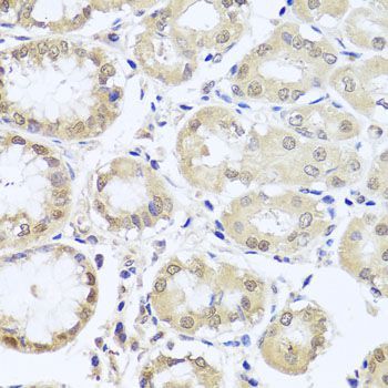 Immunohistochemistry - CGB7 antibody (144-08522)
