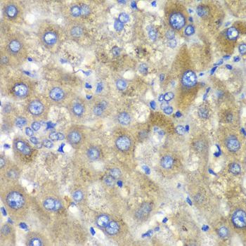 Immunohistochemistry - TLK2 antibody (144-06770)
